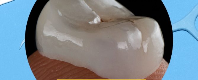 can i floss a dental crown