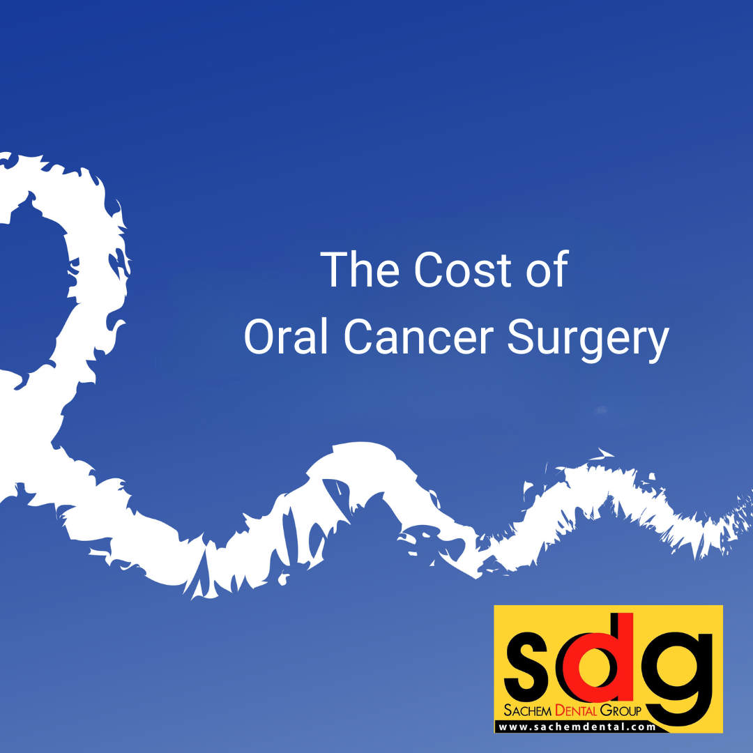 The cost of treating oral surgery