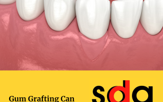 gum grafting can save your smile, receding gums, gum graft, sensitive teeth