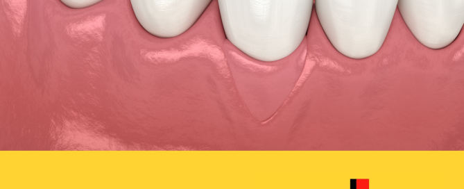 gum grafting can save your smile, receding gums, gum graft, sensitive teeth